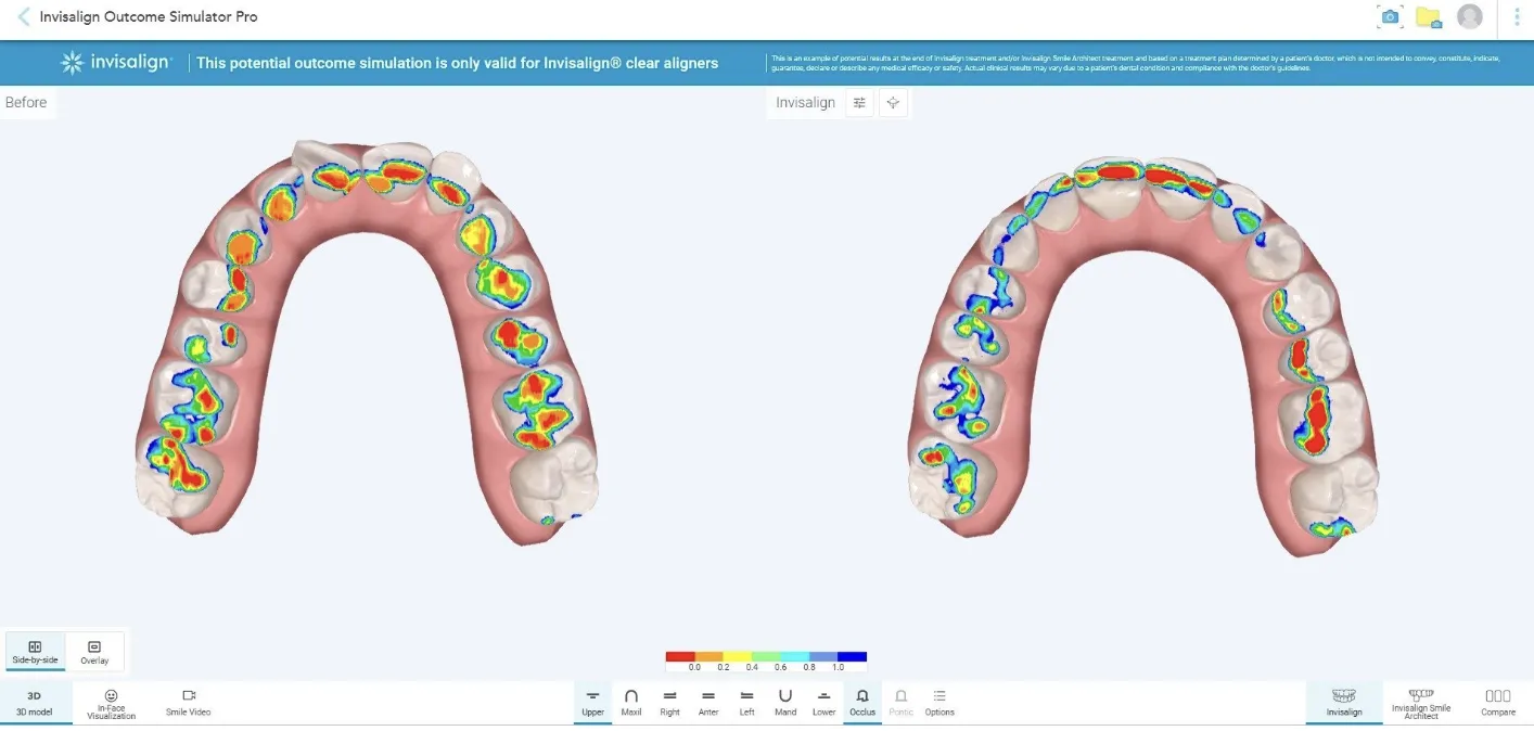 Align Technology: nuove soluzioni AI per l’odontoiatria digitale